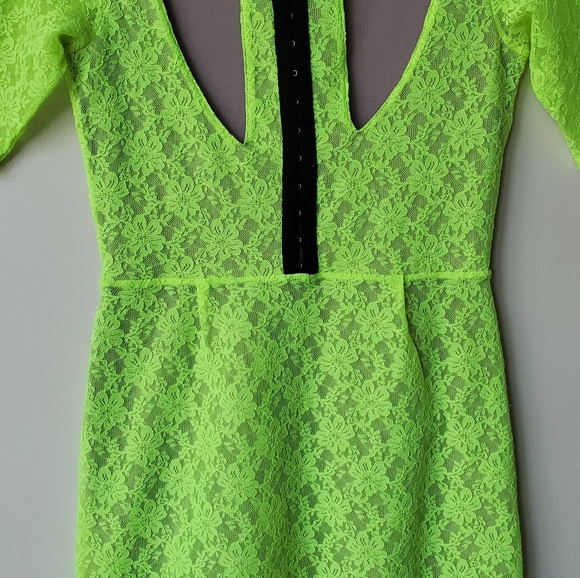 Silence + Noise Neon Lace Dress - Picture 14 of 15